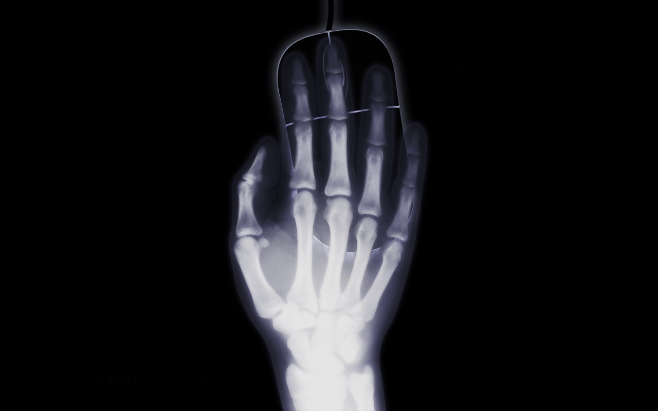 Zdjęcie rentgenowskie ręki